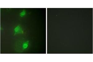 Immunofluorescence analysis of HeLa cells, using AIRE antibody. (AIRE Antikörper  (Internal Region))
