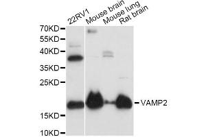 Western blot analysis of extracts of various cell lines, using VAMP2 antibody (ABIN1875306) at 1:3000 dilution. (VAMP2 Antikörper)