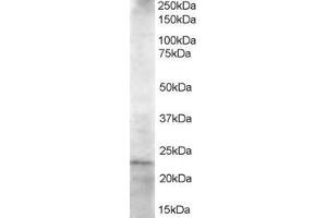 ABIN184891 staining (1. (UBE2K Antikörper  (C-Term))