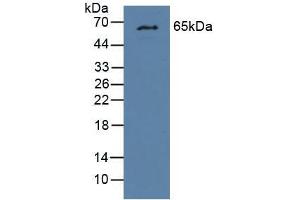 Figure. (GCKR Antikörper  (AA 17-261))