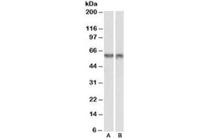 Western blot testing of nuclear mouse NIH3T3 [A] and nuclear human HeLa [B] lysates with PDCD4 antibody at 1ug/ml. (PDCD4 Antikörper)