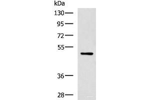 Western blot analysis of MCF-7 cell lysate using PAX2 Polyclonal Antibody at dilution of 1:400 (PAX2A Antikörper)