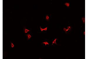 ABIN6266906 staining K-562 cells by IF/ICC. (HSPH1 Antikörper  (C-Term))