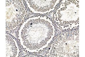 ABIN7096587 and ABIN7100651 at 1/100 staining rat testis tissue by IHC-P. (CTC1 Antikörper)
