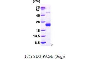 SDS-PAGE (SDS) image for DCMP Deaminase (DCTD) (AA 1-178) protein (His tag) (ABIN667034) (DCMP Deaminase (DCTD) (AA 1-178) protein (His tag))