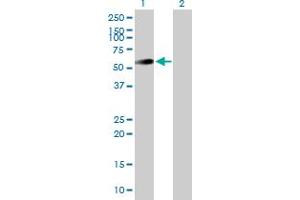 Western Blot analysis of UAP1 expression in transfected 293T cell line by UAP1 MaxPab polyclonal antibody. (UAP1 Antikörper  (AA 1-505))