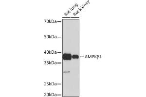 Western blot analysis of extracts of various cell lines, using AMPKβ1 Rabbit mAb (ABIN7269654) at 1:1000 dilution. (PRKAB1 Antikörper)