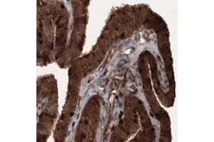 Immunohistochemical staining (Formalin-fixed paraffin-embedded sections) of human fallopian tube with PFN1 monoclonal antibody, clone CL3524  shows cytoplasmic immunoreactivity in epithelial cells. (PFN1 Antikörper)