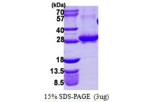 SDS-PAGE (SDS) image for RAB3A, Member RAS Oncogene Family (RAB3A) (AA 1-220) protein (His tag) (ABIN7279483)