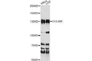 Western blot analysis of extracts of various cell lines, using GOLIM4 antibody (ABIN6291706) at 1:1000 dilution.