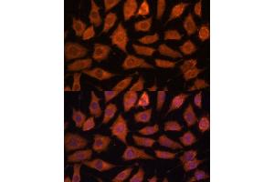Immunofluorescence analysis of L929 cells using Legumain (Legumain (LGMN)) Polyclonal Antibody (ABIN6128201, ABIN6143172, ABIN6143173 and ABIN6214867) at dilution of 1:100 (40x lens). (LGMN Antikörper  (AA 18-323))