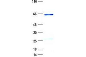 Western Blotting (WB) image for Secreted Frizzled-Related Protein 2 (SFRP2) protein (GST tag,His tag) (ABIN5505766)