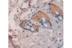 IHC-P analysis of Kidney tissue, with DAB staining. (IL1F10 Antikörper  (AA 15-152))