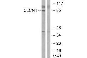 Western Blotting (WB) image for anti-Chloride Channel 4 (CLCN4) (Internal Region) antibody (ABIN1851086) (CLCN4 Antikörper  (Internal Region))