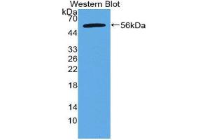 Western Blotting (WB) image for anti-Apoptosis Antagonizing Transcription Factor (AATF) (AA 273-477) antibody (ABIN2118436) (AATF Antikörper  (AA 273-477))
