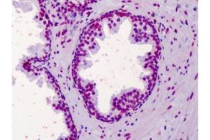 Human Prostate: Formalin-Fixed, Paraffin-Embedded (FFPE) (Aryl Hydrocarbon Receptor Antikörper  (N-Term))