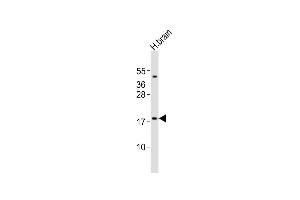 Anti-CALY Antibody (N-term)at 1:2000 dilution + human brain lysates Lysates/proteins at 20 μg per lane. (CALY Antikörper  (N-Term))