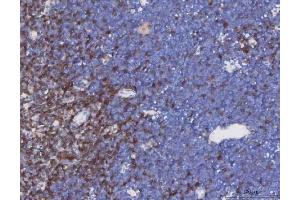 IHC analysis of TCR alpha/TRAC using anti-TCR alpha/TRAC antibody (ABIN6719654). (TRAC Antikörper  (AA 1-114))