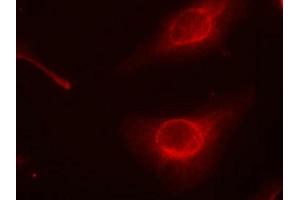 Immunofluorescence staining of methanol-fixed Hela cells using cofilin(Phospho-Ser3) Antibody. (Cofilin Antikörper  (pSer3))