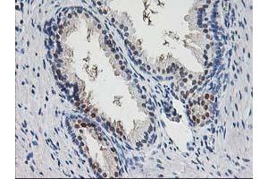 Immunohistochemical staining of paraffin-embedded Human prostate tissue using anti-PNMT mouse monoclonal antibody.