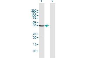 Western Blot analysis of EPM2A expression in transfected 293T cell line by EPM2A MaxPab polyclonal antibody.