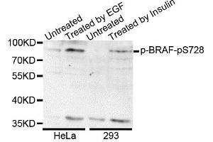 Western blot analysis of extracts of various cell lines, using Phospho-BRAF-S728 antibody.