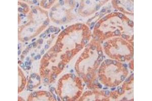 Used in DAB staining on fromalin fixed paraffin- embedded Kidney tissue (M6PR Antikörper  (AA 27-185))