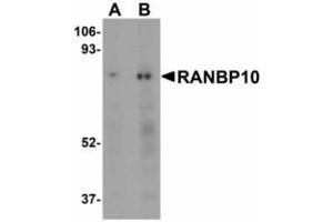 Image no. 1 for anti-RAN Binding Protein 10 (RANBP10) (Internal Region) antibody (ABIN478260) (RANBP10 Antikörper  (Internal Region))