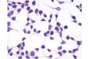 Anti-GPR4 antibody immunocytochemistry (ICC) staining of untransfected HEK293 human embryonic kidney cells. (GPR4 Antikörper  (C-Term))