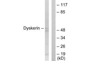 Western Blotting (WB) image for anti-Dyskeratosis Congenita 1, Dyskerin (DKC1) (Internal Region) antibody (ABIN1849014) (DKC1 Antikörper  (Internal Region))