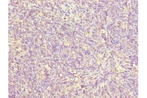 Immunohistochemistry of paraffin-embedded human thymus tissue using ABIN7176109 at dilution of 1:100 (ZNF131 Antikörper  (AA 80-379))