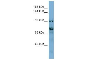 WB Suggested Anti-TMEM146 Antibody Titration: 0. (TMEM146 Antikörper  (Middle Region))