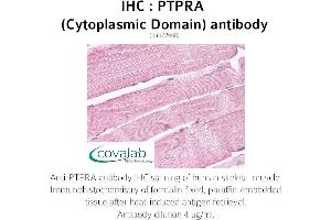 Image no. 2 for anti-Protein tyrosine Phosphatase, Receptor Type, A (PTPRA) antibody (ABIN1738604)