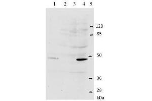 Western Blotting (WB) image for anti-Human Papilloma Virus Type 11 (HPV-11) (AA 202-284) antibody (ABIN781775) (Human Papilloma Virus Type 11 (HPV-11) (AA 202-284) Antikörper)