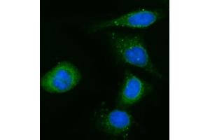 IF analysis of CYB5R3 using anti-CYB5R3 antibody (ABIN7600822). (CYB5R3 Antikörper  (AA 24-301))