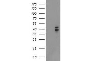 Western Blotting (WB) image for anti-NudE Nuclear Distribution E Homolog (A. Nidulans)-Like 1 (NDEL1) antibody (ABIN1499853) (NDEL1 Antikörper)