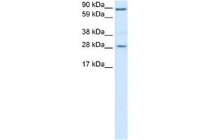 WB Suggested Anti-BCL2 Antibody Titration:  0. (Bcl-2 Antikörper  (N-Term))