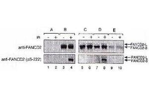 FA-D2 fibroblasts were stably transfected with either pMMP (empty vector, A), FANCD2 (wt, B), FANCD2 (S222A, C), FANCD2 (triple mutant, D), or FANCD2 (quadruple mutant, E). (FANCD2 Antikörper  (pSer222))
