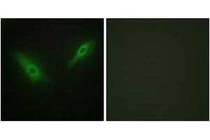 Immunofluorescence analysis of HeLa cells, using KPB1/2 Antibody. (KPB1/2 (AA 31-80) Antikörper)