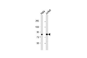 All lanes : Anti-CHUK Antibody (C-term) at 1:1000 dilution Lane 1: Hela whole cell lysate Lane 2: Jurkat whole cell lysate Lysates/proteins at 20 μg per lane. (IKK alpha Antikörper  (C-Term))