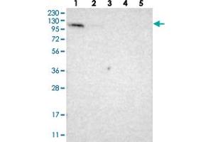 Western blot analysis of Lane 1: RT-4, Lane 2: U-251 MG, Lane 3: Human Plasma, Lane 4: Liver, Lane 5: Tonsil with LONP2 polyclonal antibody . (LONP2 Antikörper)