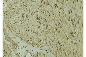 ABIN6277295 at 1/100 staining Mouse muscle tissue by IHC-P. (MEF2C Antikörper  (C-Term))