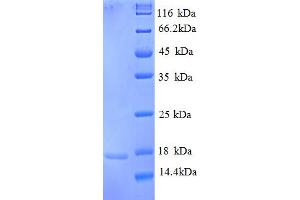 SDS-PAGE (SDS) image for Replication Protein A3, 14kDa (RPA3) (AA 1-119), (partial) protein (His tag) (ABIN5713008)