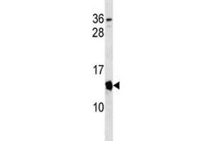 Cdkn2a antibody western blot analysis in mouse spleen tissue lysate. (CDKN2A Antikörper  (AA 39-65))
