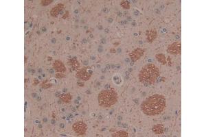 Used in DAB staining on fromalin fixed paraffin- embedded Kidney tissue (PLA2G2D Antikörper  (AA 20-134))
