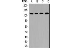 Western blot analysis of CNGA3 expression in BT474 (A), U87 (B), mouse pancreas (C), rat liver (D) whole cell lysates. (CNGA3 Antikörper)