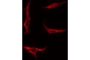 Immunofluorescence (fixed cells) (IF/ICC) image for anti-VEGF Receptor 2 (VEGFR2) (pTyr1214) antibody (ABIN6256627)
