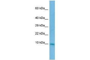 WB Suggested Anti-CC2D2A Antibody Titration: 1.