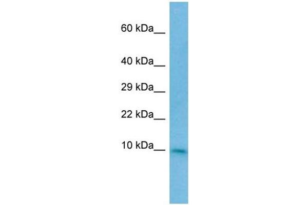 CC2D2A Antikörper  (N-Term)