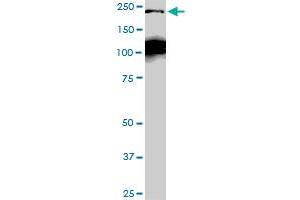 CDC42BPB monoclonal antibody (M04), clone 2D8. (CDC42BPB Antikörper  (AA 1580-1679))